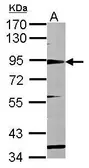 Anti-CD168 / RHAMM antibody [N1N2], N-term used in Western Blot (WB). GTX121502