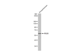 Anti-PLD3 antibody [N1C1] used in Western Blot (WB). GTX122218