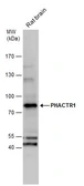 Anti-PHACTR1 antibody used in Western Blot (WB). GTX122251