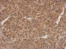 Anti-PROSC antibody used in IHC (Paraffin sections) (IHC-P). GTX122706