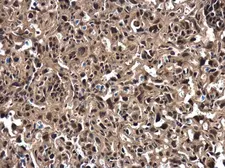 Anti-ZFAT antibody used in IHC (Paraffin sections) (IHC-P). GTX122715