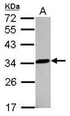 Anti-LACTB2 antibody used in Western Blot (WB). GTX122755