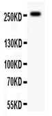 Anti-ABCA4 antibody used in Western Blot (WB). GTX12302