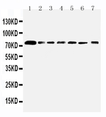Anti-SPARCL1 antibody used in Western Blot (WB). GTX12308