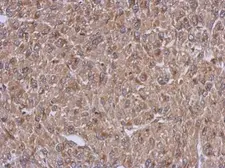 Anti-ARFIP1 antibody used in IHC (Paraffin sections) (IHC-P). GTX123214