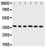 Anti-CDK7 antibody used in Western Blot (WB). GTX12373