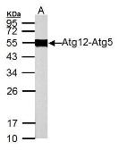 Anti-ATG12 antibody used in Western Blot (WB). GTX124181