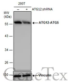 Anti-ATG12 antibody used in Western Blot (WB). GTX124181