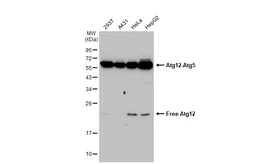 Anti-ATG12 antibody used in Western Blot (WB). GTX124181