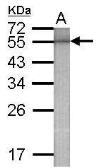 Anti-Beta-gal antibody used in Western Blot (WB). GTX124230