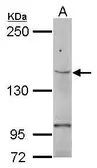 Anti-TERT antibody [C2C3-2], C-term used in Western Blot (WB). GTX124242