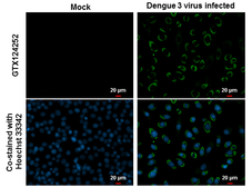 Anti-Dengue virus NS3 protein antibody used in Immunocytochemistry/ Immunofluorescence (ICC/IF). GTX124252