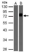 Anti-Biotin antibody used in Western Blot (WB). GTX124262