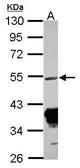 Anti-Rxraa+b antibody used in Western Blot (WB). GTX124342