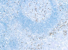 Anti-IRF4 / MUM1 antibody [MUM1p] used in IHC (Paraffin sections) (IHC-P). GTX12501