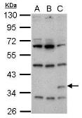 Anti-Renilla Luciferase antibody used in Western Blot (WB). GTX125853