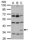 Anti-Renilla Luciferase antibody used in Western Blot (WB). GTX125853