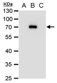 Anti-Japanese encephalitis virus NS3 antibody used in Western Blot (WB). GTX125868