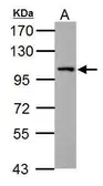 Anti-Thbs4b antibody used in Western Blot (WB). GTX125869