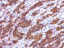 Anti-Galectin 4 antibody used in IHC (Paraffin sections) (IHC-P). GTX125898