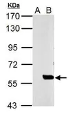 Anti-SLU7 antibody used in Western Blot (WB). GTX125935