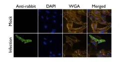 Anti-Influenza A virus M2 (matrix protein) antibody used in Immunocytochemistry/ Immunofluorescence (ICC/IF). GTX125951