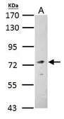 Anti-Fmr1 antibody used in Western Blot (WB). GTX125996