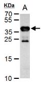 Anti-Cre recombinase antibody used in Western Blot (WB). GTX127270