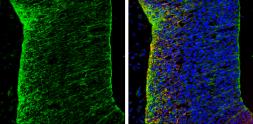 Anti-N-Cadherin antibody used in IHC (Frozen sections) (IHC-Fr). GTX127345