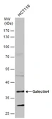 Anti-Galectin 4 antibody used in Western Blot (WB). GTX127351