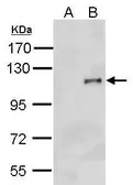 Anti-HA tag antibody (HRP) used in Western Blot (WB). GTX127376-01