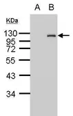 Anti-HA tag antibody used in Western Blot (WB). GTX127376