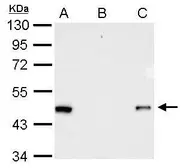 Anti-RFP antibody used in Immunoprecipitation (IP). GTX127897