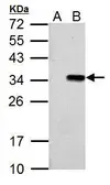Anti-T7 tag antibody used in Western Blot (WB). GTX128059