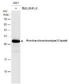Anti-Porcine circovirus type 2 / PCV2 Capsid antibody used in Western Blot (WB). GTX128121