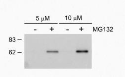 Anti-SQSTM1 / P62 (phospho Ser403) antibody used in Western Blot (WB). GTX128171