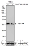 Anti-SQSTM1 / P62 antibody used in Western Blot (WB). GTX128173