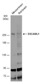 Anti-DSCAML1 antibody used in Western Blot (WB). GTX128231