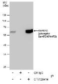 Anti-AKT (phospho Ser473) antibody used in Immunoprecipitation (IP). GTX128414