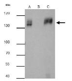Anti-mCherry antibody used in Immunoprecipitation (IP). GTX128509