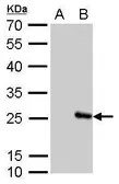 Anti-Influenza B virus M (matrix protein) antibody used in Western Blot (WB). GTX128536