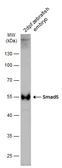 Anti-Smad5 antibody used in Western Blot (WB). GTX128642
