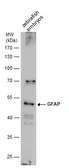 Anti-Gfap antibody used in Western Blot (WB). GTX128644