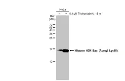 Anti-Histone H3K18ac (Acetyl Lys18) antibody used in Western Blot (WB). GTX128943