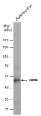 Anti-TANK antibody used in Western Blot (WB). GTX129037