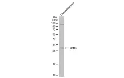 Anti-Uchl3 antibody used in Western Blot (WB). GTX129067