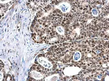 Anti-MCM6 antibody used in IHC (Paraffin sections) (IHC-P). GTX129218