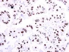 Anti-HNF1 beta antibody used in IHC (Paraffin sections) (IHC-P). GTX129236