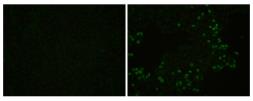 Anti-PRRS virus Nucleocapsid protein antibody used in Immunocytochemistry/ Immunofluorescence (ICC/IF). GTX129270