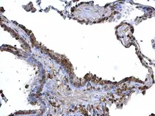 Anti-ARID3B antibody used in IHC (Paraffin sections) (IHC-P). GTX129352